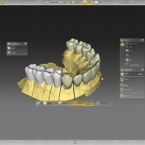 Software de laboratorio dental - inLab  - DENTSPLY MAILLEFER - de implantología dental / para restauración dental / de diseño