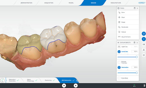 Software de análisis - CEREC - DENTSPLY MAILLEFER - de monitorización / de captura / de laboratorio dental