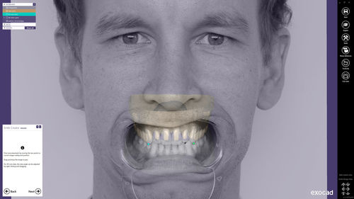 Software de análisis - Smile Creator - exocad GmbH   - de planificación / de diseño / de CAD