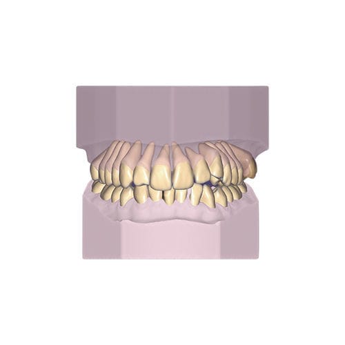 Módulo de software de diseño - Ortho - exocad GmbH   - de modelado / de archivo / ortodóntico