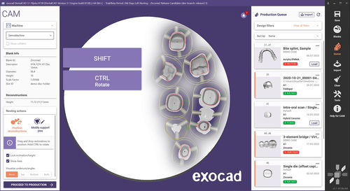 Software de gestión de datos - exocam - exocad GmbH   - de visualización / de diseño / de CAD