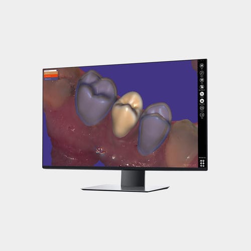 Módulo de software de captura - Provisional  - exocad GmbH   - de control / de CAD / para odontología