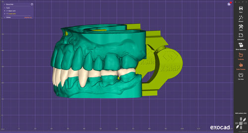 Módulo de software de CAD - xSNAP - exocad GmbH   - de impresión / para odontología / de articulación
