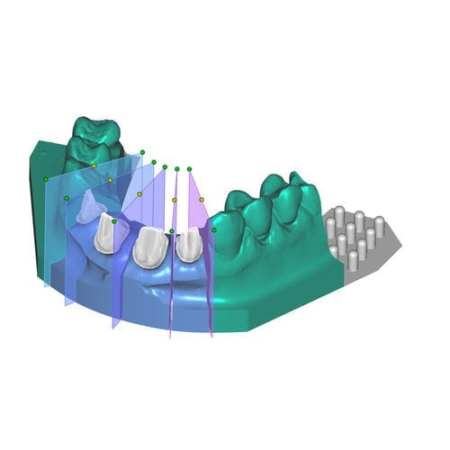 Módulo de software de captura - Model Creator - exocad GmbH   - de diseño / de modelado / para odontología