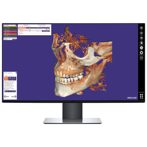 Módulo de software de visualización - DICPDCAD - exocad GmbH   - de visualización DICOM / de diagnóstico / de control