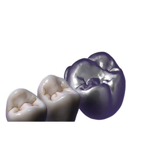 Módulo de software de control - TruSmile  - exocad GmbH   - de diseño / de CAD / para restauración dental