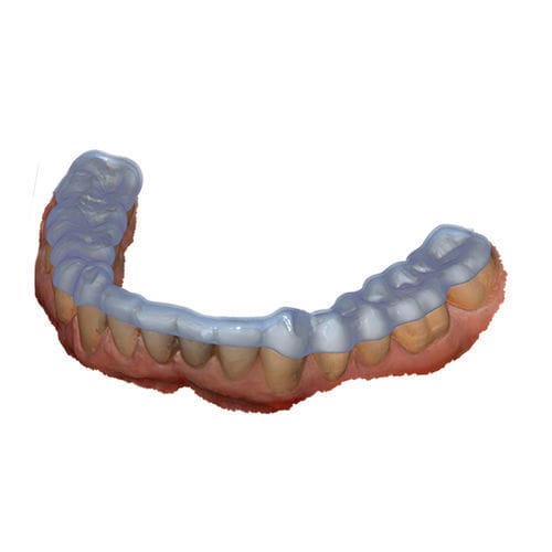 Módulo de software de diseño - Bite Splint - exocad GmbH   - para odontología / de articulación