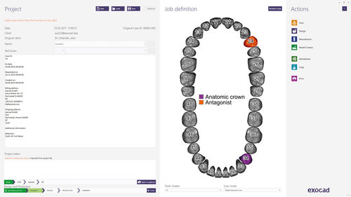 Software de gestión - dentalshare - exocad GmbH   - de diseño / de CAD / de intercambio