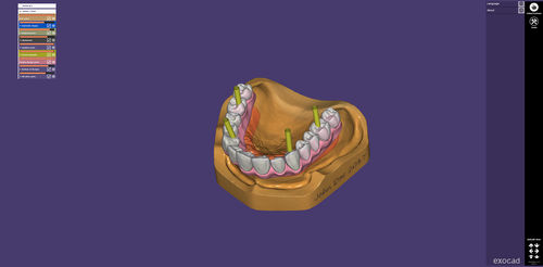 Aplicación web de intercambio - webview - exocad GmbH   - de visualización 3D / médica / para odontología