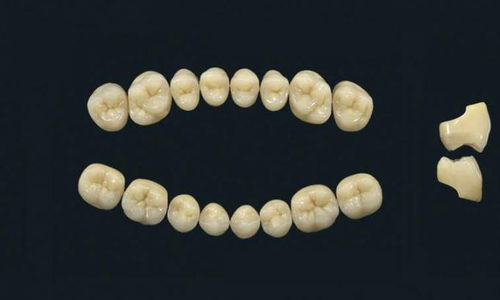 Prótesis dental de polímero acrílico - TRIBOS 501 SM-UJ-B1 - GEBDI Dentalproducts GmbH   - para dientes posteriores