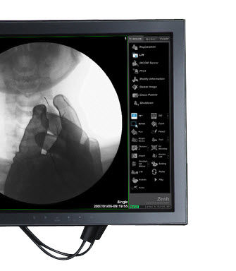 Software de adquisición - ZENIS - Genoray - de gestión / para imágenes médicas