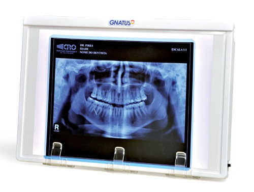 Negatoscopio 1 pantalla - Gnatus - con interruptor / para odontología / de luz blanca
