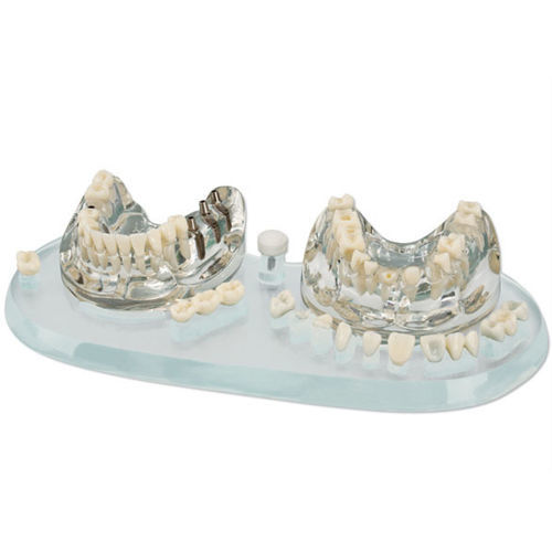 Modelo anatómico de dentadura - 355638 - Hager & Werken - de implantología / de demostración