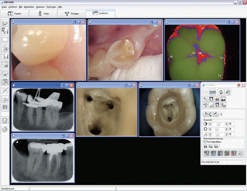 Software de visualización - DBSWIN  - Dürr Dental - de diagnóstico / de planificación / de diseño