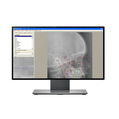 Software para imagen dental - DFO - IMAGELEVEL - para imagen ortopédica / de análisis cefalométrico / para tablet PC