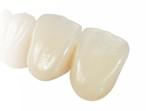 Prótesis dental de circona - Prime - Ivoclar Vivadent