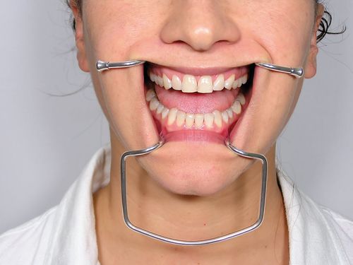 Retractor mejillas - CRO2 - Jakobi Dental GmbH - para odontología / para adulto / de acero inoxidable