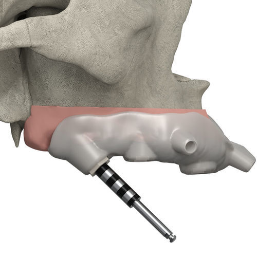 Motor quirúrgico taladradora - JD P.A.G.A  - JDENTALCARE SRL   - eléctrico / para cirugía craneomaxilofacial