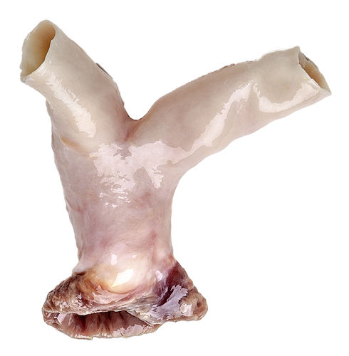 Bioprótesis valvular pulmonar - CardioGraft® - Lifenet Health  