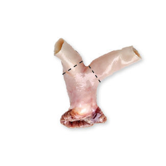 Bioprótesis vascular arteria pulmonar - CardioGraft® - Lifenet Health   - alotrasplante
