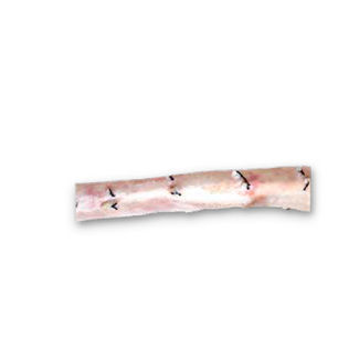 Bioprótesis vascular de aorta torácica - CardioGraft® - Lifenet Health   - alotrasplante