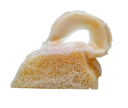 Prótesis de menisco alotrasplante - FlexiGRAFT®  - Lifenet Health  