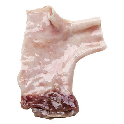 Bioprótesis vascular arteria pulmonar - CardioGraft ® - Lifenet Health   - alotrasplante