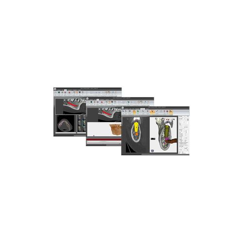Software de implantología dental - S3D - MARIOTTI & C - de simulación en 3D / de hueso / mandibular