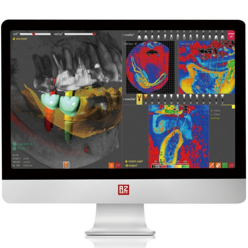 Software de planificación - R2GATE - Megagen Implant - de simulación de implante dental / FAO / de creación de prótesis dentales