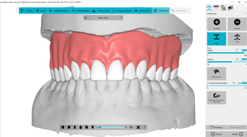 Software de análisis - BDCreator® PLUS - Merz Dental GmbH   - de diseño / de importación / de impresión