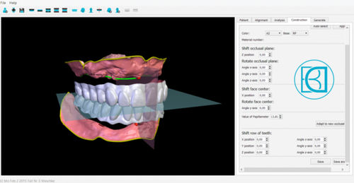 Software de análisis - BDCreator® - Merz Dental GmbH   - de control / de visualización / de creación de prótesis dentales