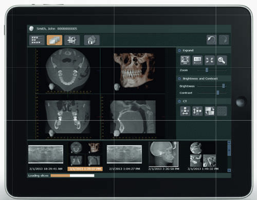 Software de diagnóstico - i-Dixel Web - Morita - de visualización / de gestión de datos / para imagen dental