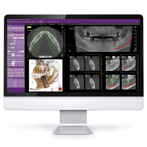 Software para imagen dental - iRYS - MyRay - de archivo DICOM / de análisis de imágenes / visualizador