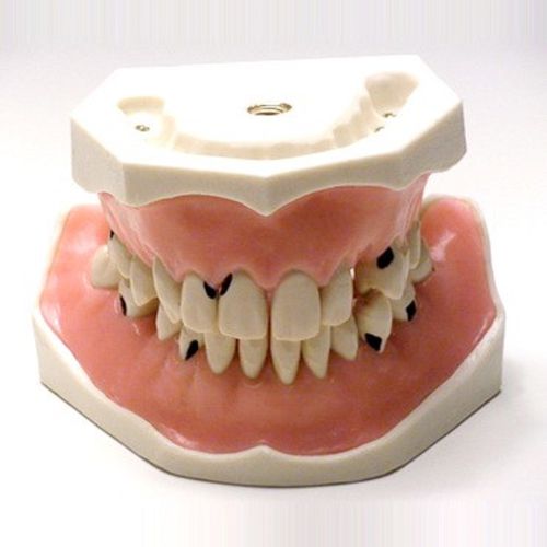 Modelo anatómico de dentadura - SP005 - Navadha Enterprises   - para periodoncia / de formación