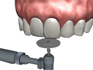Software para cirugía dental - NA501  - Navadha Enterprises   - de tratamiento / de educación / periodontal