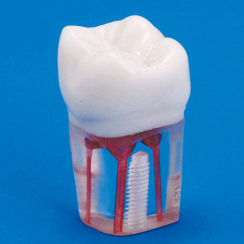 Modelo anatómico de dientes - S12A-200 - Nissin Dental Products Inc.   - de canal radicular / de formación / transparente