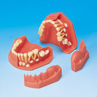 Modelo anatómico de dentadura - PE-PDI004 - Nissin Dental Products Inc.   - de encías / de formación / infantil