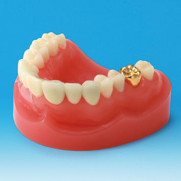 Modelo anatómico de dentadura - PE-PRO001 - Nissin Dental Products Inc.   - de encías / de prótesis dental / de formación