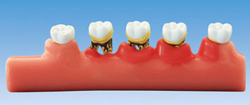 Modelo anatómico para odontología - PE-PER010 - Nissin Dental Products Inc.   - de hueso costal / para periodoncia / de formación