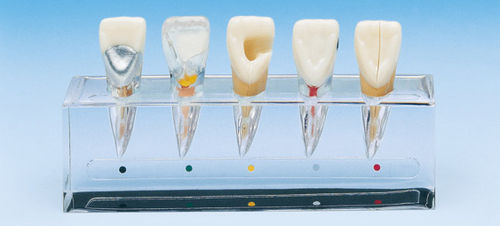 Modelo anatómico para odontología - PE-END001 - Nissin Dental Products Inc.   - de canal radicular / para endodoncia / de formación
