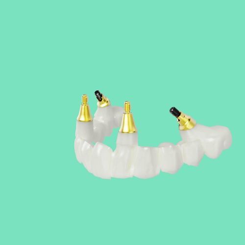 Puente dental de titanio - NobelProcera® - Nobel Biocare Services AG   - de circona / de los dientes anteriores / para dientes posteriores