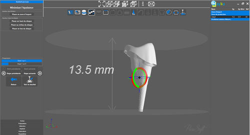 Software de laboratorio - PICASOFT SAS   - para odontología / de CAD / de creación de prótesis dentales