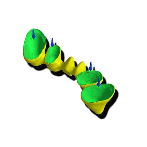 Software para odontología - Margin Line - PICASOFT SAS   - de CAD / de dentadura