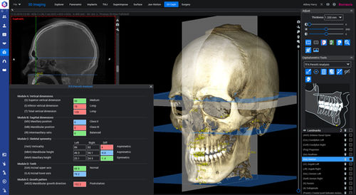 Módulo de software para ortodoncia - Romexis® 3D - Planmeca - para cirugía maxilofacial / para odontología / para imagen dental
