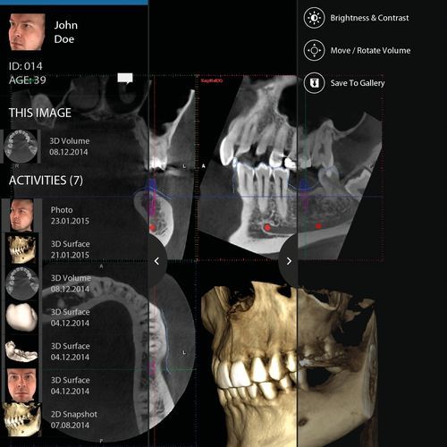 Aplicación para iOS de visualización - mRomexis™ - Planmeca - de captura / clínica / para odontología