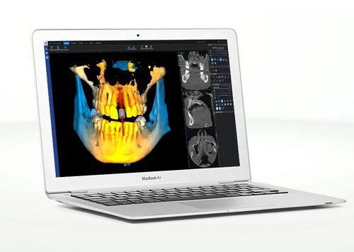 Aplicación web visualizador - Romexis®  - Planmeca - médica / para odontología / para odontología