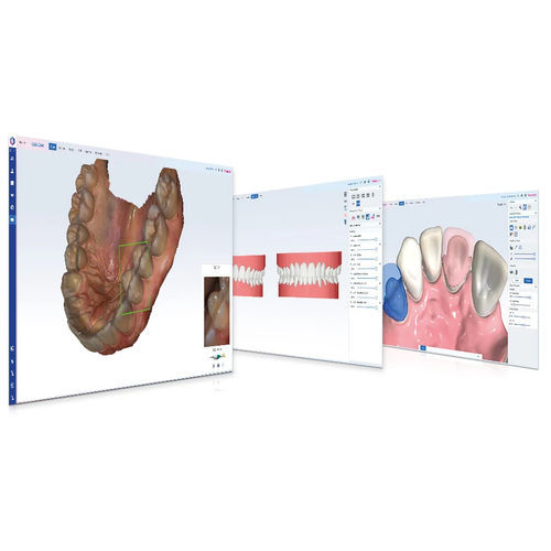 Módulo de software para odontología - Romexis® CAD/CAM - Planmeca - para imagen dental / para ortodoncia / de laboratorio dental
