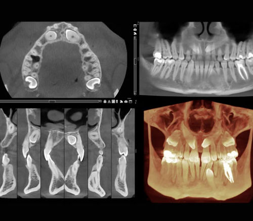 Software médico - Romexis® - Planmeca - para odontología / para imágenes médicas / para cirugía maxilofacial