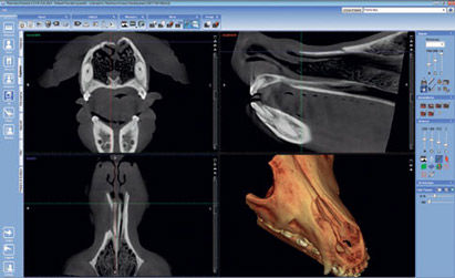 Software de análisis de imágenes - Romexis® - Planmeca - de mejora de la imagen / de visualización / de diagnóstico