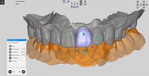 Software para odontología - RAYDENT designer - Ray - de diseño / para tablet PC